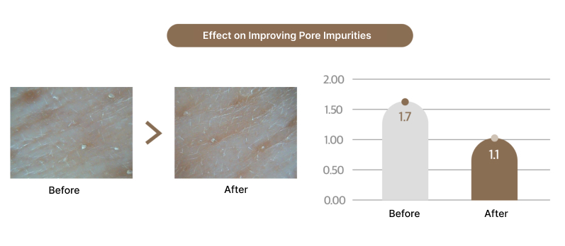 【Megu様確認用】インセルダム　 ENZYME CLEANSER EX Megu様確認用】インセルダム ENZYME CLEANSER EX Incellderm Products